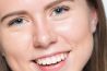 Nabewerking: glimmende huid corrigeren